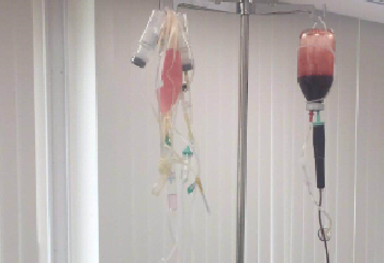 客人案例：A2一对夫妇干细胞期待年轻化