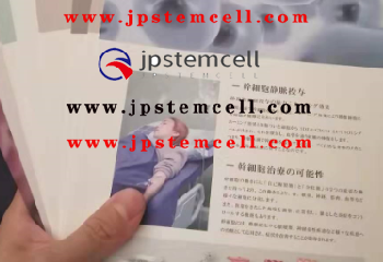 客人案例：A9干细胞治疗，干细胞治疗勃起无力ED